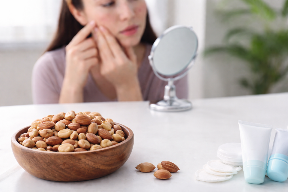 Mitos Kacang Bikin Jerawatan, Ini Penjelasan Medis yang Perlu Diketahui